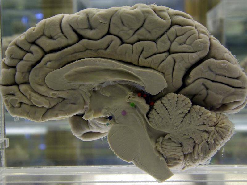 A new study had delivered a startling warning about brain health.