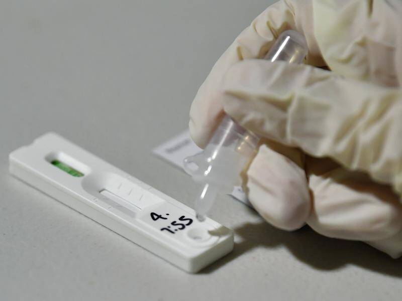 The rapid antigen tests analyse a nasal swab or saliva for the presence of the coronavirus.